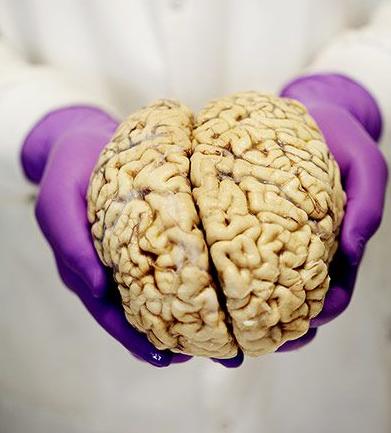 神经病理学家演示人脑解剖全过程