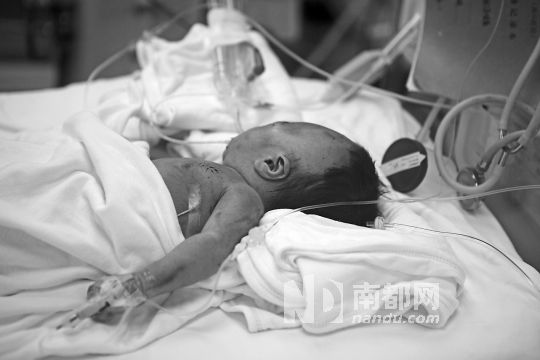 6月11日，被丢在深圳南山区南园村一个垃圾桶内的男婴仍在抢救。 南都记者霍健斌摄