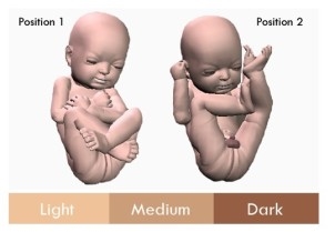 3D打印胎儿模型：让孕妇与腹中宝宝提前“见面”