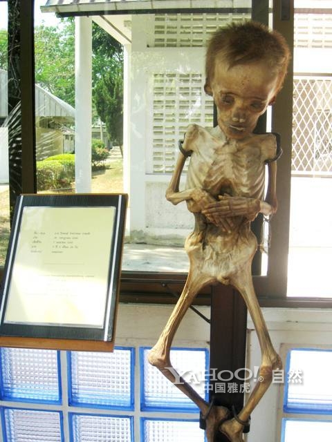 探秘泰国人体博物馆 胆小慎入(组图)