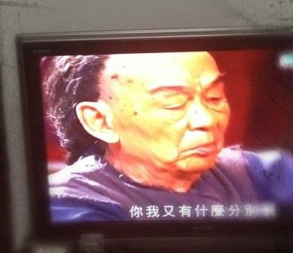 TVB83岁老戏骨颈长巨型肿瘤 乐观拍戏感动网