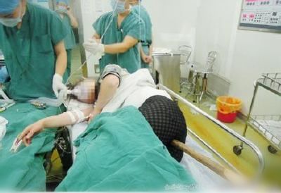 噩梦!女子疑丈夫有外遇 剪伤情敌下体和胸部