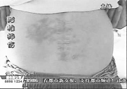 济南高中生玩游戏致高中状告骨折腰椎索赔20议论钻牛角尖要同学图片