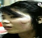 女子遭抢劫被吓大出血