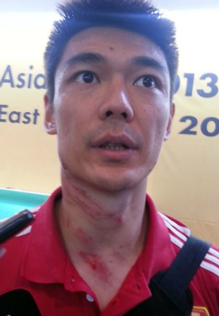 2013年7月24日，东亚四强赛，中国男足0-0韩国。门将曾诚遭对手爆踹，脖颈留下多处血痕。