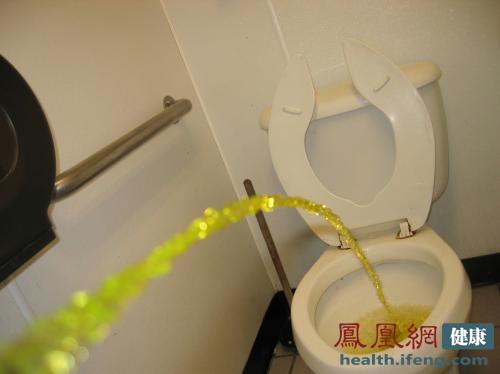 此外,如果男士患有前列腺炎,尿液中可能携带前列腺液,这样会在尿液