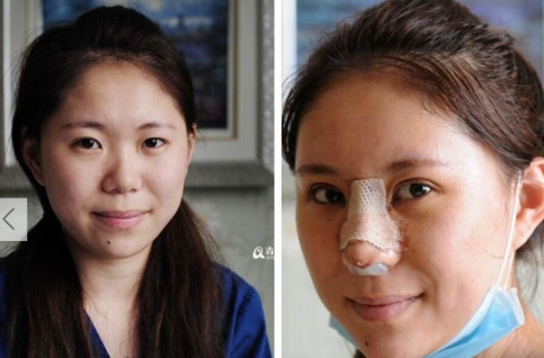 25岁青岛<em>女孩</em>直播<em>整容</em> 术后第一句话:我还活着