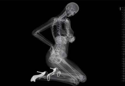 另类之美:X线下的<em>美女人体艺术</em>_健康频道_凤