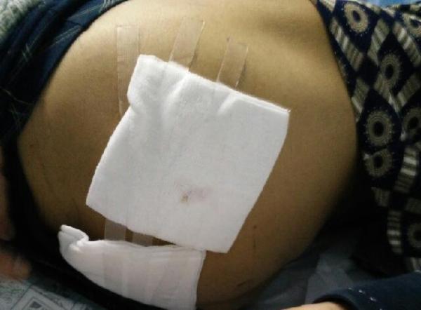 福州警方回应枪支走火伤人