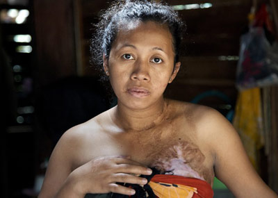 被虐待的东南亚佣工