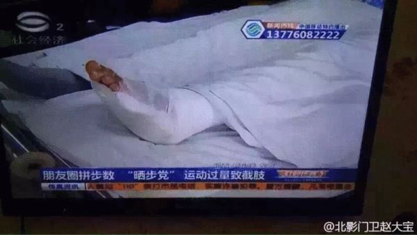 女子朋友圈拼步数 为争第一险些失去双脚