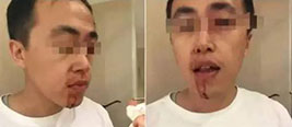 夫妻想一起进试衣间被拒 欲投诉遭店员暴打