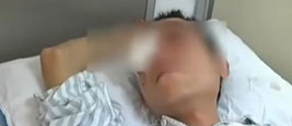 广东男子遇骗局 遭剜眼球后丢弃路边
