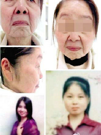 如何做手术变成女人 ori_56d78242c1cbf.jpeg