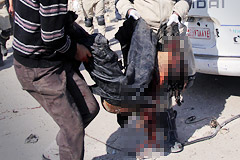 叙利亚：空袭过后