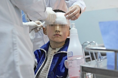 院的急诊室里,医生给冬冬缝针后包扎伤口.-乌鲁木齐城管摊贩冲突.