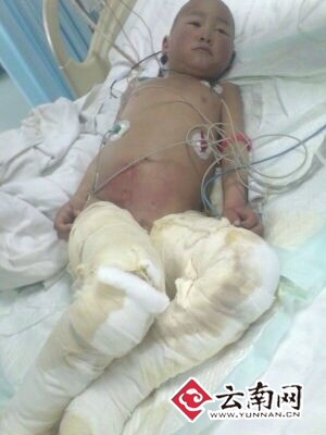 云南昭通母亲求助:请救救我的孩子!