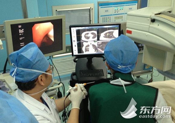 汪浩操作支气管“导航仪”为患者检查
