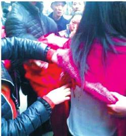 被气枪击中的行人。（图据网络）