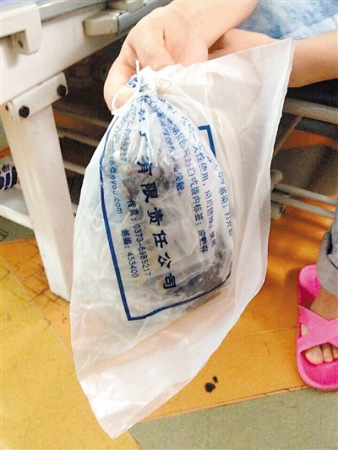 女孩患异食癖2岁<em>吃头发</em> 5年后发丝缠满胃(图