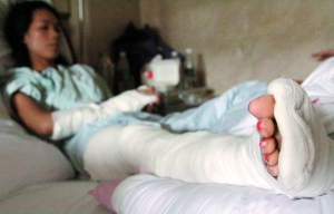 女子右腿受伤严重,现在已经打上石膏。信息时报实习生 钟至晟 记者 陆明杰 摄