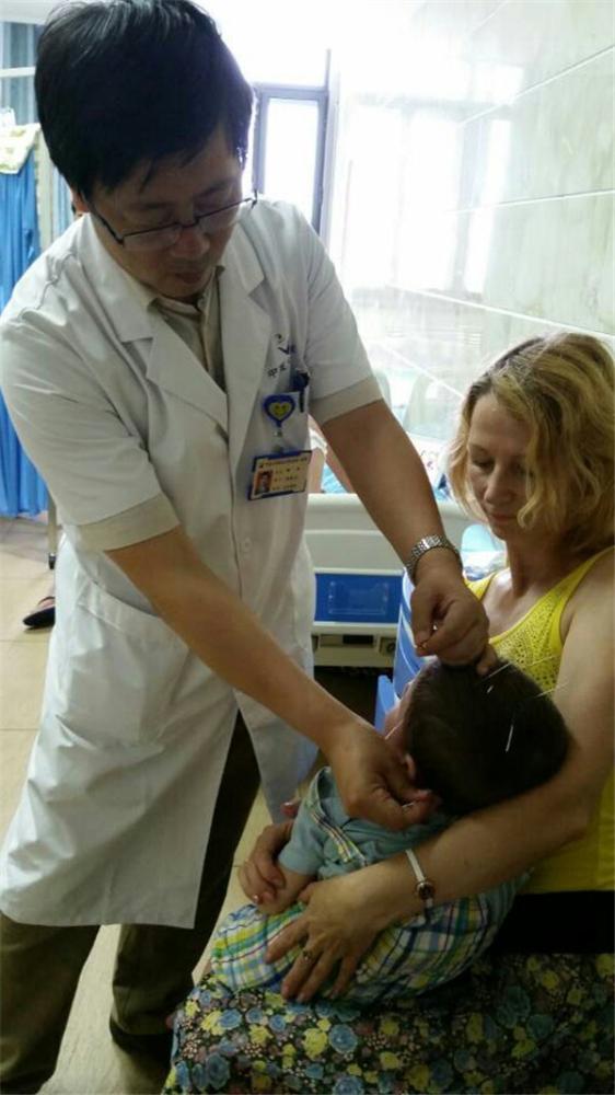 俄罗斯脑瘫患儿在黑龙江省中医药大学附属第一医院接受针灸治疗