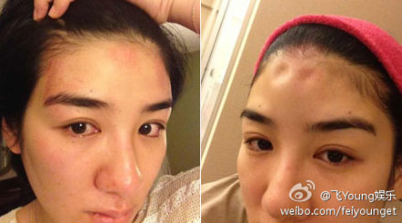 曹格 老婆 吴速玲整容前照曝光:被爆隆鼻削脸|曹