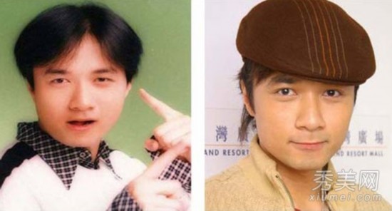 古巨基（疑似整容部位：眼睛。）