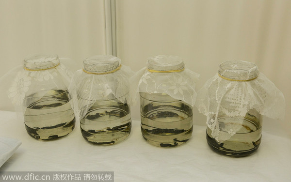 当地时间2014年10月17日，俄罗斯别尔哥罗德地区，一名女子在疗养院体验水蛭疗法。