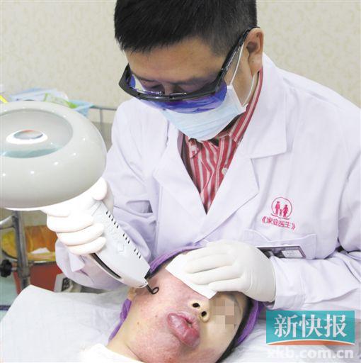 大学生红胎记病变致面部畸形