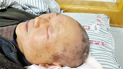 他把白发染黑后,整个人都不好了!|<em>头皮</em>|<em>头发</em>_凤