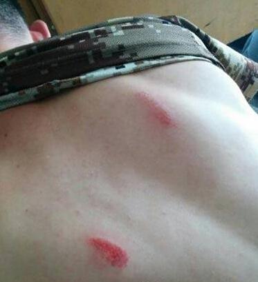 媒体评爱国青年被围殴:情感比事实清楚|官微