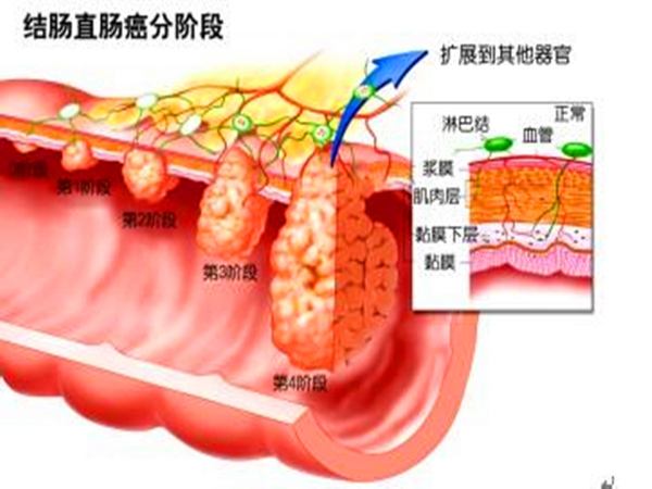 　　18%，听起来怪吓人的哦。我们怎么来看待这个数值呢？