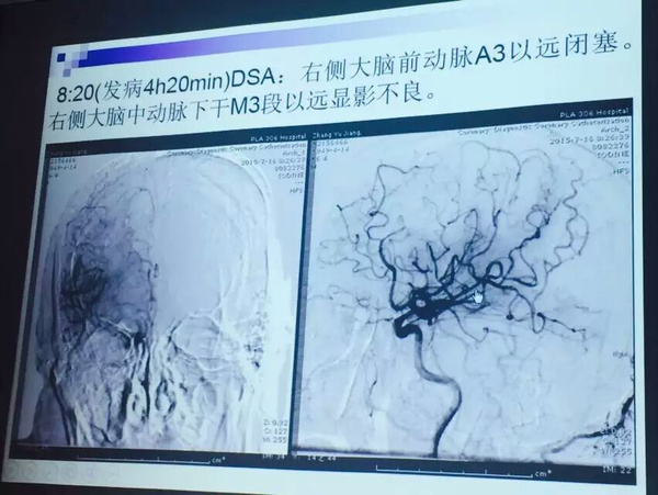 医护人员晨读相关病例