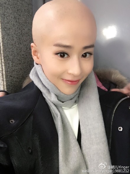 颖儿晒光头照自称卤蛋 网友:颜值高就是任性