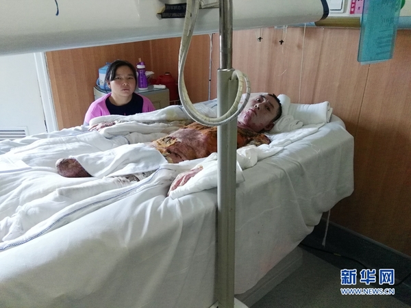 袁龙华虽然右腿没了,但仍然渴望新生。