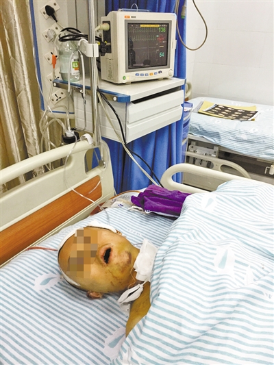 孟长伟仍处于昏迷状态。