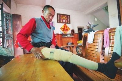 晋江西园街道的赖昌豆正整理义肢。几年前的车祸让他失去了一条腿，在慈善总会和残联的帮助下，他申请到了困难户的免费义肢安装，现在他能独立生活，并且开始养殖肉兔。
