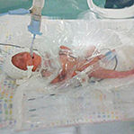 医生用塑料袋救早产儿