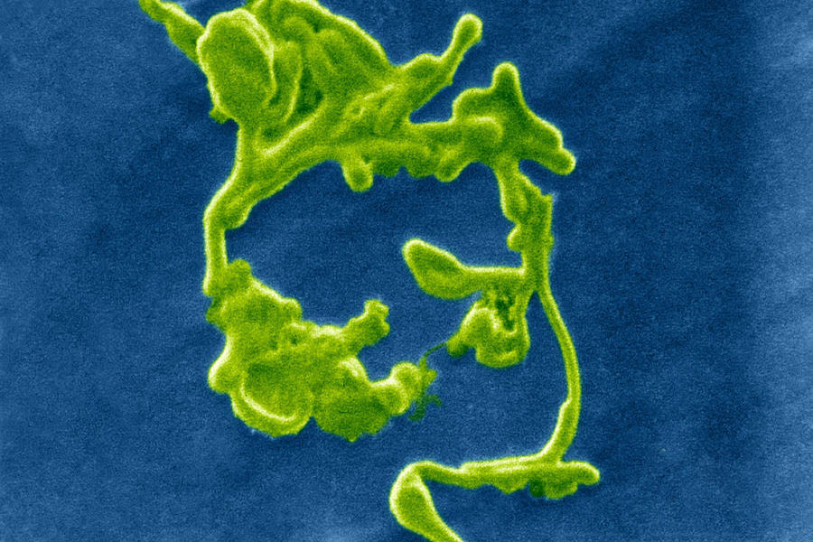 尽管医学家们绞尽脑汁，作过许多探索，但埃博拉病毒的真实“身份”，至今仍为不解之谜。没有人知道埃博拉病毒在每次大爆发后潜伏在何处 ，也没有人知道每一次埃博拉疫情大规模爆发时，第一个受害者是从哪里感染到这种病毒的。