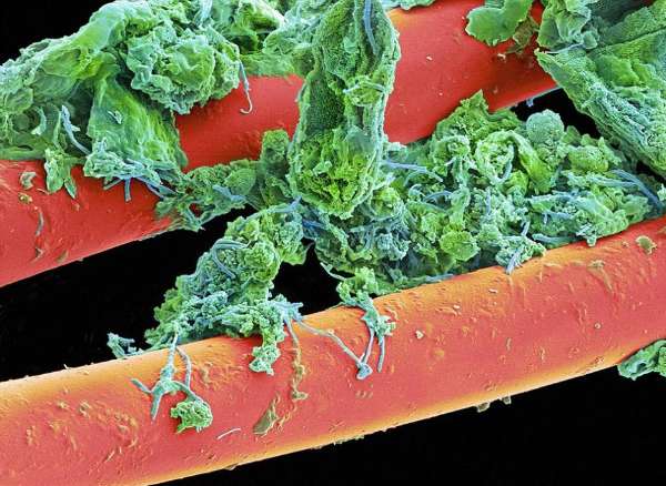 显微镜下的牙齿细菌色彩斑斓 令人毛骨悚然_海南频道_凤凰网