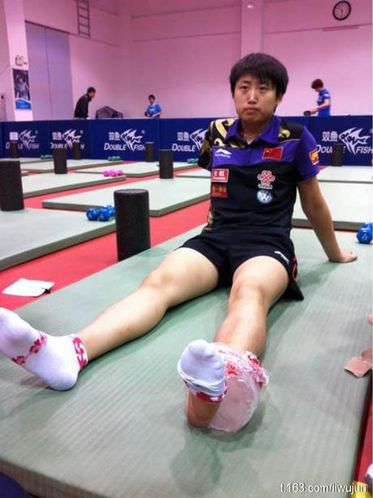 <em>女乒</em>集训备战多特蒙德<em>世乒赛</em> 郭跃受伤敷冰袋
