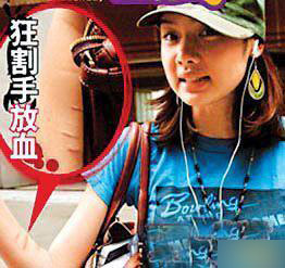 盘点女星<em>自残自虐</em>事 大S剪掉身上肉叶玉卿吃蛔