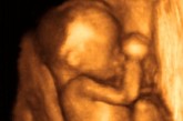 《美国妇产科学杂志》也曾记录了一位女性胎儿自慰的全部过程，研究者看到一个32周的女性胎儿用右手手指触摸外阴，主要是集中在抚摸阴蒂的区域。这一活动持续了30 - 40秒，过了一段时间又再次开始，并伴随着骨盆和双腿的活动。在之后，胎儿的躯干和四肢的肌肉呈现出达到高潮的肌肉痉挛，最终放松休息，这一过程持续了近20分钟。
