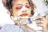 2005年10月9日，时年21岁的美国姑娘莎娜·里查森在阿肯色州高空跳伞时，因主副降落伞都无法打开，她就像秤砣一样从3000多米高空坠落地面。脸先着地的莎娜奇迹般地没有摔死，就连腹中2周大的胎儿也安然无恙！孩子安然出生后6周，莎娜便重返蓝天再次跳伞。