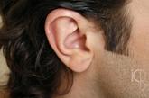 3.扫外耳

以双手把耳朵由后向前扫，这时会听到“嚓嚓”的声音。每次20下，每日数次，只要长期坚持，必能强肾健身。

