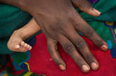 当地时间2012年4月17日，20岁的母亲Hereta Moussa将手放在她7个月大的儿子Mahamat Choukou腿上。Mahamat Choukou因为极度营养不良，引发了肺部感染。

