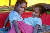 印度孟加拉邦巴斯尔哈特市现年40岁的甘加·蒙达尔和贾姆娜·蒙达尔姐妹是一对连体双胞胎，她们从腰部相连，拥有两颗心脏、两只肾脏、4条胳膊、3条腿、一只肝脏和一副生殖器官，姐妹俩必须手脚并用才能在地上爬行，所以她们也获得了一个“蜘蛛女”的绰号。