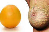 葡萄柚乳房

柑橘类水果长得像乳腺，橘子的抗氧化剂含量是所有水果中最高的，含170多种不同的植物化学成分。食用时橘络不要扔掉，可缓解乳腺增生症状。

