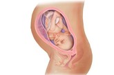 完美孕育全面解析：廿九周

现在开始你已经进入孕晚期了。大多数孕妇在这一阶段将增重5公斤左右。这时胎儿体重大约已有1300多克，身长大约43厘米了。此时胎儿还会睁开眼睛并把头转向从妈妈子宫壁外透射进来的光源。现在胎儿的皮下脂肪已初步形成，手指甲也已能看得很清楚了。不规则的宫缩此时也时有发生，你会觉得肚子偶尔会一阵阵地发硬发紧，这是正常的。走路多一些或身体疲劳时更易发生，因此要注意休息，不要走太远的路或长时间站立。


